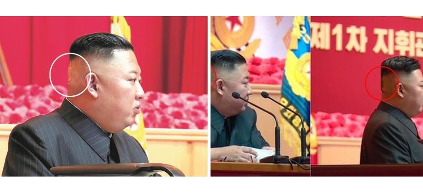道格·班多：如果没有明确继承人的朝鲜失去了金正恩，意味着什么?